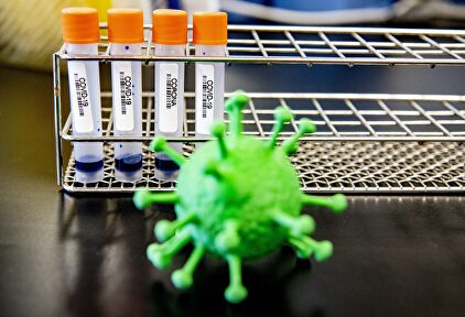 Muestras de laboratorio de Coronavirus | Cordon Press