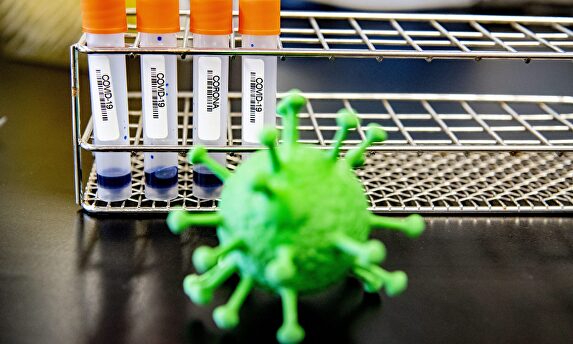 Muestras de laboratorio de Coronavirus | Cordon Press