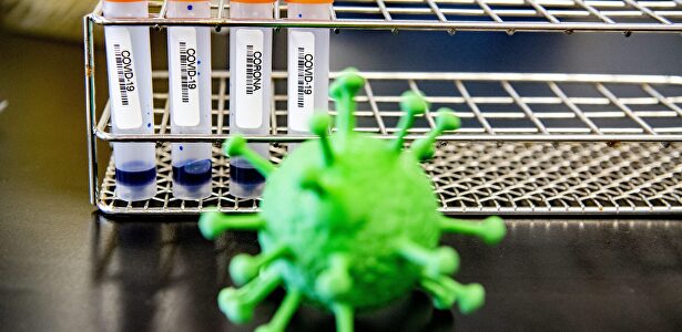 Muestras de laboratorio de Coronavirus | Cordon Press