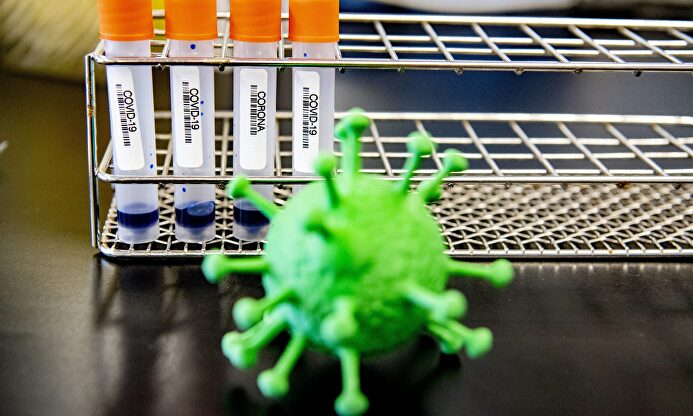 Muestras de laboratorio de Coronavirus | Cordon Press