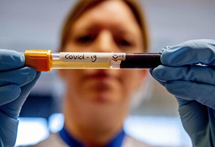 Test serológico de coronavirus | Cordon Press