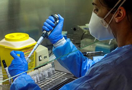 Una imagen del laboratorio del Hospital Puerta de Hierro, en Madrid. | EFE