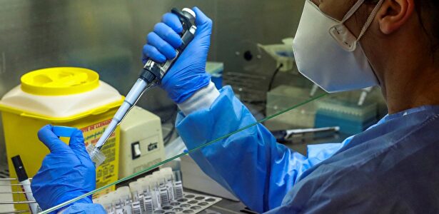 Laboratorio del Hospital Puerta de Hierro, en Madrid. | EFE