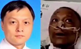 Hu Weifeng, uno de los dos médicos chinos que se convirtieron en negros por el tratamiento contra el coronavirus. | Imagen TV