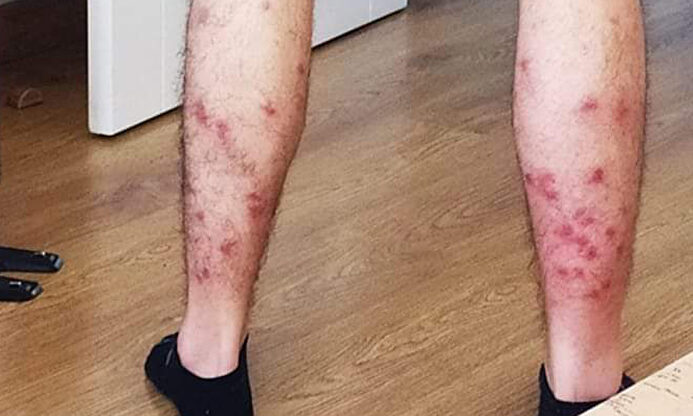 Las moscas negras se ensañaron con el deportista | Twitter @rcbenitez