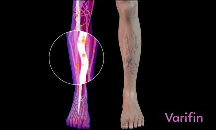 Mundo Natural 19: Los beneficios del deporte