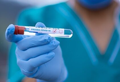 Prueba de covid-19. | FERNANDO ZHIMINAICELA/UCC-UCM