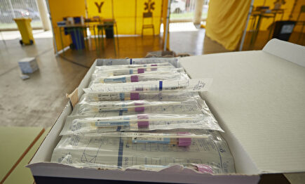 Material para realizar pruebas PCR | Europa Press