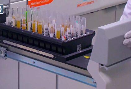 Rusia pone en circulación el primer lote de su vacuna contra el coronavirus 