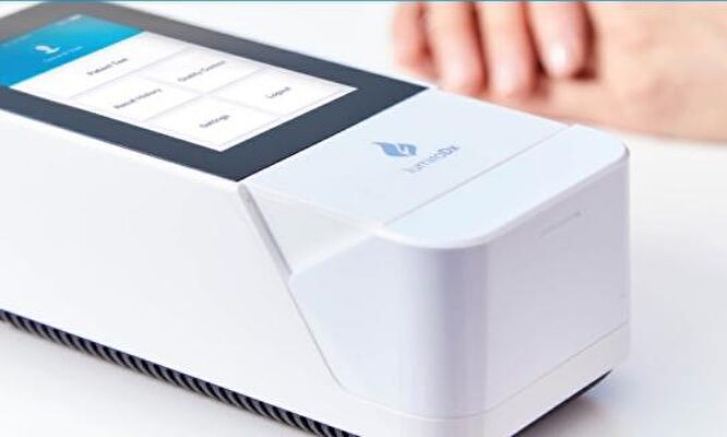 El nuevo dispositivo tiene una sensibilidad superior a cualquier otro test rápido. | Servimedia