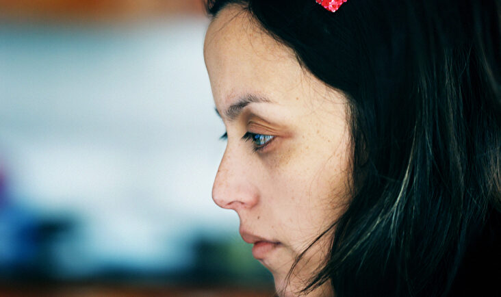 Técnicas para combatir las ojeras