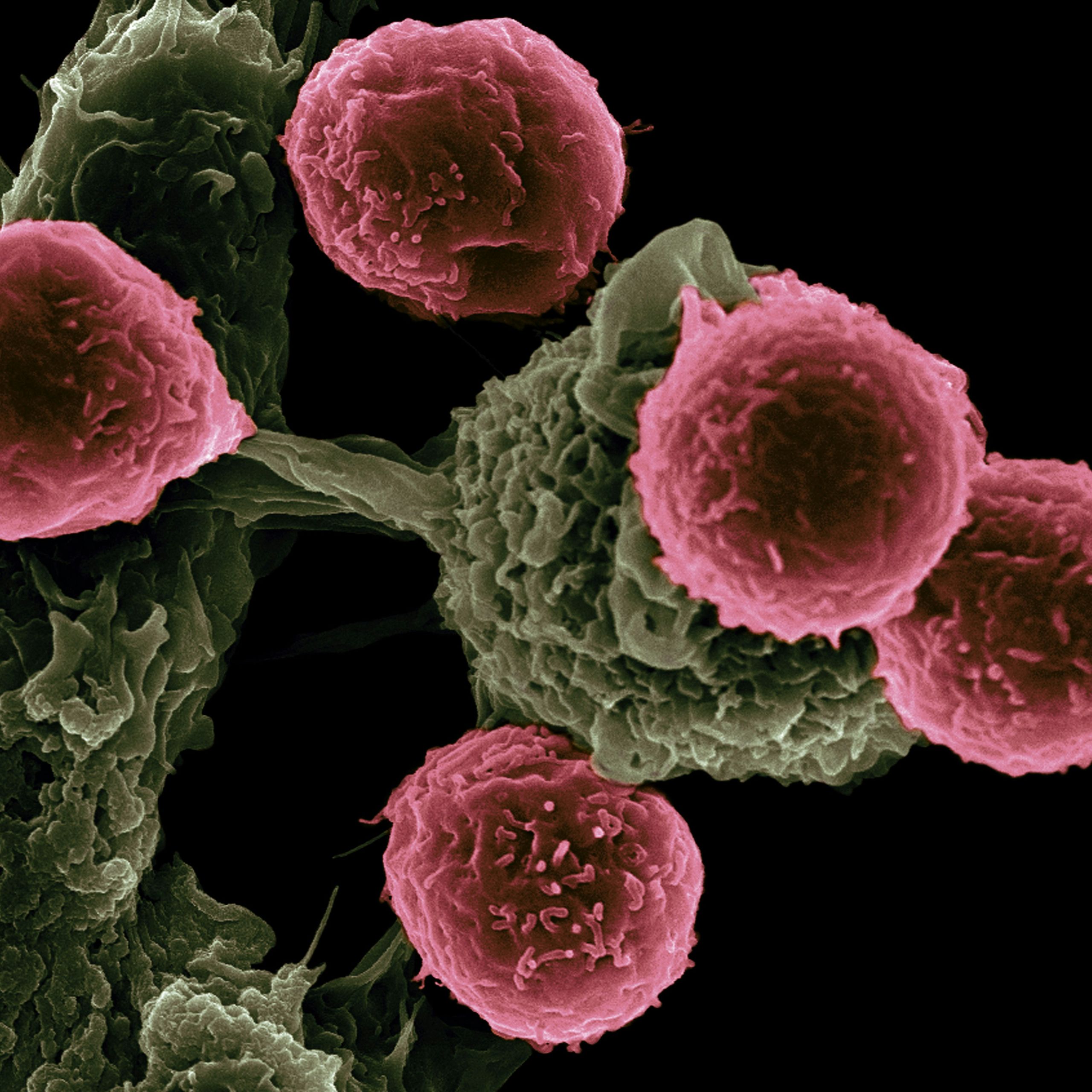 Crean en ratones células T cien veces más potentes contra el cáncer