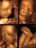Imágenes de un feto con 29, 33 y 36 semanas. Tomadas de erpayo.com.