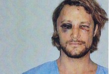 Gabrial Aubry muestra sus heridas | Cordon Press