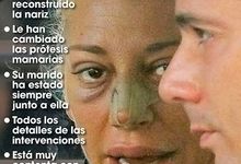 Beln Esteban, operada en Slvame