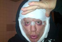 Mickey Rourke | National Enquirer