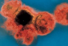 Virus del sida | Archivo