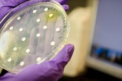 Un tcnico de laboratorio sujetando una placa de Petri. | Corbis