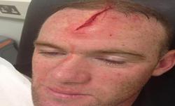 Wayne Rooney muestra su impactante brecha en las redes sociales. | Foto: Facebook