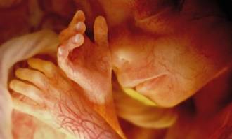 Alabama y la cruel realidad del aborto en EEUU