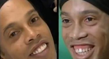 El antes y el despus en la sonrisa de Ronaldinho. | Globo TV