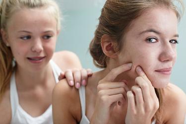 Aunque el acn se asocia a adolescentes, cada vez afecta a ms adultos. | Corbis