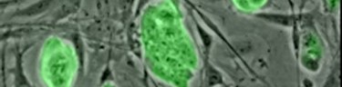 Células madre | Wikipedia