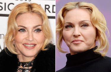 Madonna antes y despus | Cordon Press
