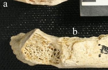 Restos del neandertal analizado | Plos One