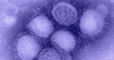 Imagen del virus de la Gripe A/H1N1 | dicyt.com